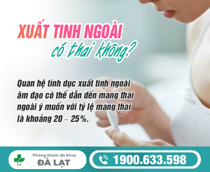 Hình ảnh minh họa